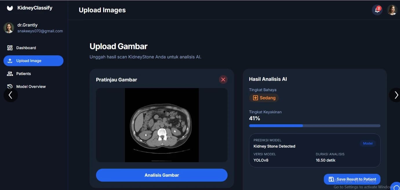 Kidney Stone - AI Detection Batu Ginjal